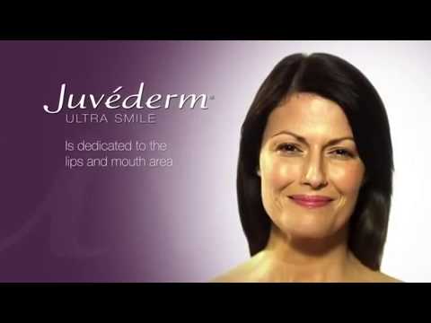 Injekcijas ar Juvederm Smile