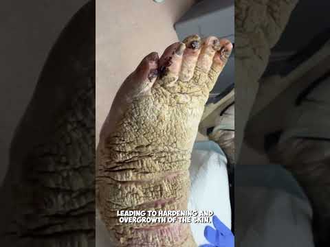 ساق لحاء الشجرة