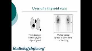 Your Radiologist Explains: Thyroid Gland and Scan