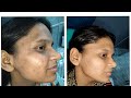 GLOWING SKIN IS FOR EVERYONE ! YOU DESERVE IT ! 
