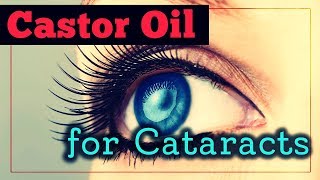Castor Oil For Cataracts: Does It Work And How To Use It?