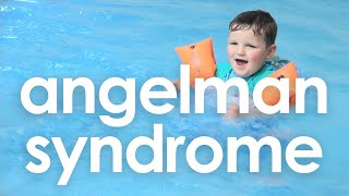 Angelman Syndrome in one word - Angelman UK