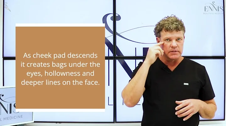 About the Mid Face and Mid Facelift Surgery