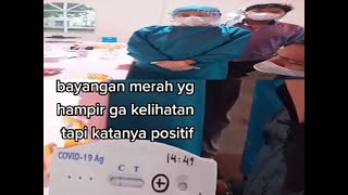 CARA MEMBACA HASIL SWAB PCR DAN RAPID TES ANTIBODI COVID-19