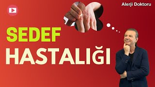 Sedef Hastalığı - Alerji Doktoru Prof. Dr. Ahmet Akçay Resimi