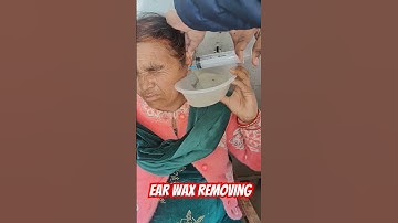 Thumbnail of Removal of Ear Wax by Syringing Method #trending #viral #motivation #ytshorts #bamslife #mbbs#doctor