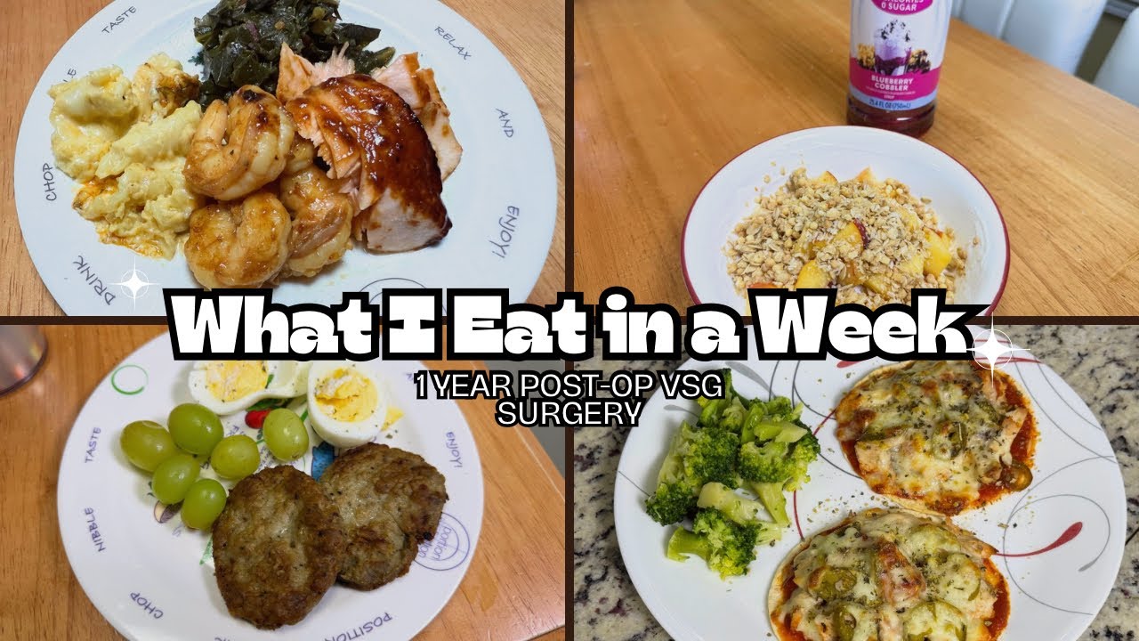VSG JOURNEY | WHAT I EAT IN A WEEK 1 YEAR POST-OP | BARIATRIC SURGERY | GASTRIC SLEEVE