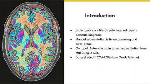 CSE 427 Lab Project (Brain MRI Segmentation by using U-Net Architecture)