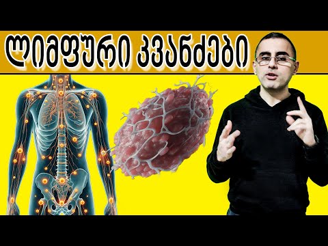 ლიმფური ჯირკვლების გადიდება - რა იწვევს და როდის არის საშიში