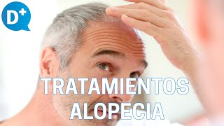 Los mejores tratamientos para combatir la alopecia