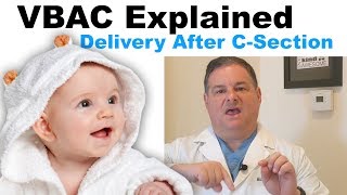 VBAC/TOLAC Explained. Everything about delivery after c-section.