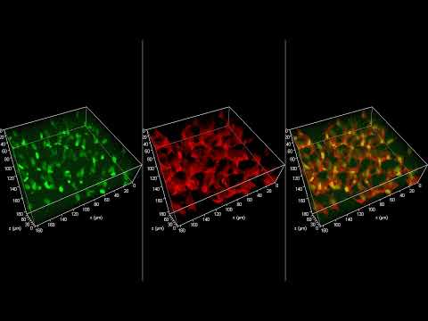 The Mechanics of Metastasis