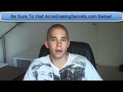 birth-control-pills-for-acne-treatment?
