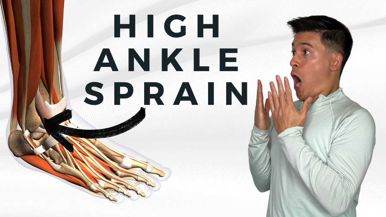 High Ankle Sprain Diagnosis and Rehab Exercises - YouTube