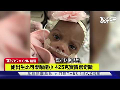 【CNN精選】剛出生比可樂罐還小 425克寶寶寫奇蹟｜TVBS新聞
