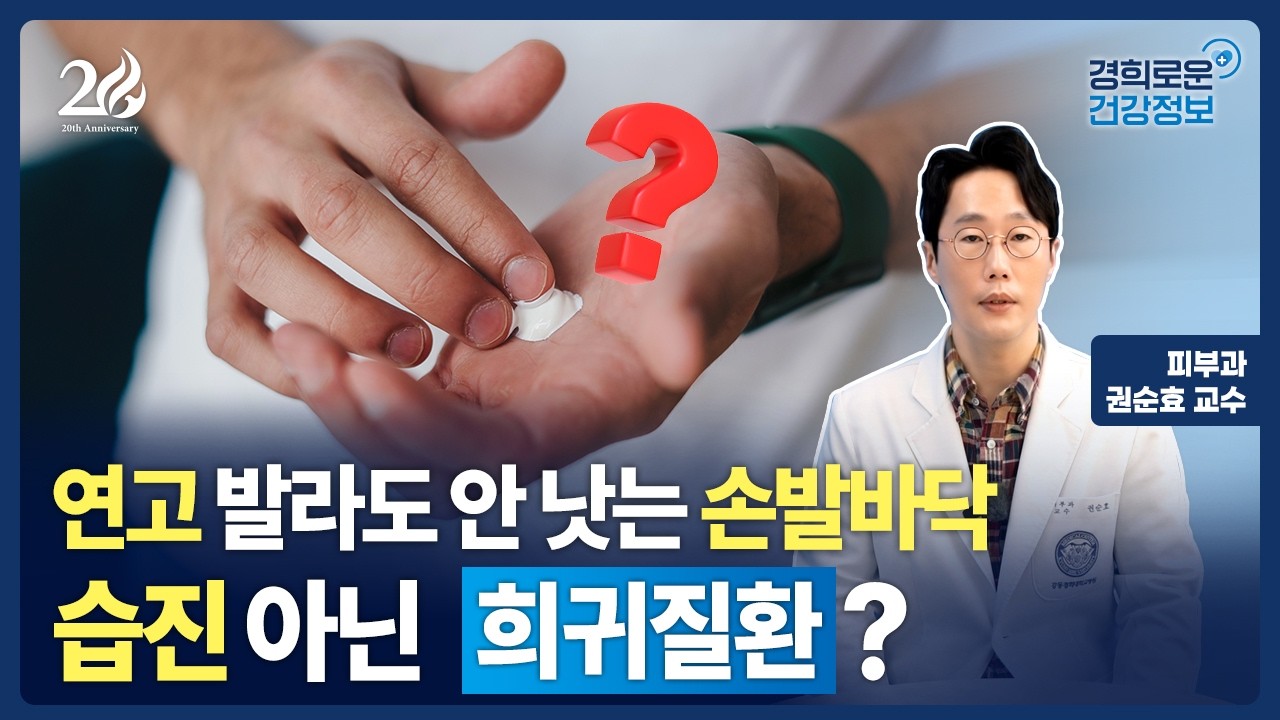 연고 발라도 안 낫는 손발바닥, 습진 아닌 희귀질환? [피부과 권순효 교수]