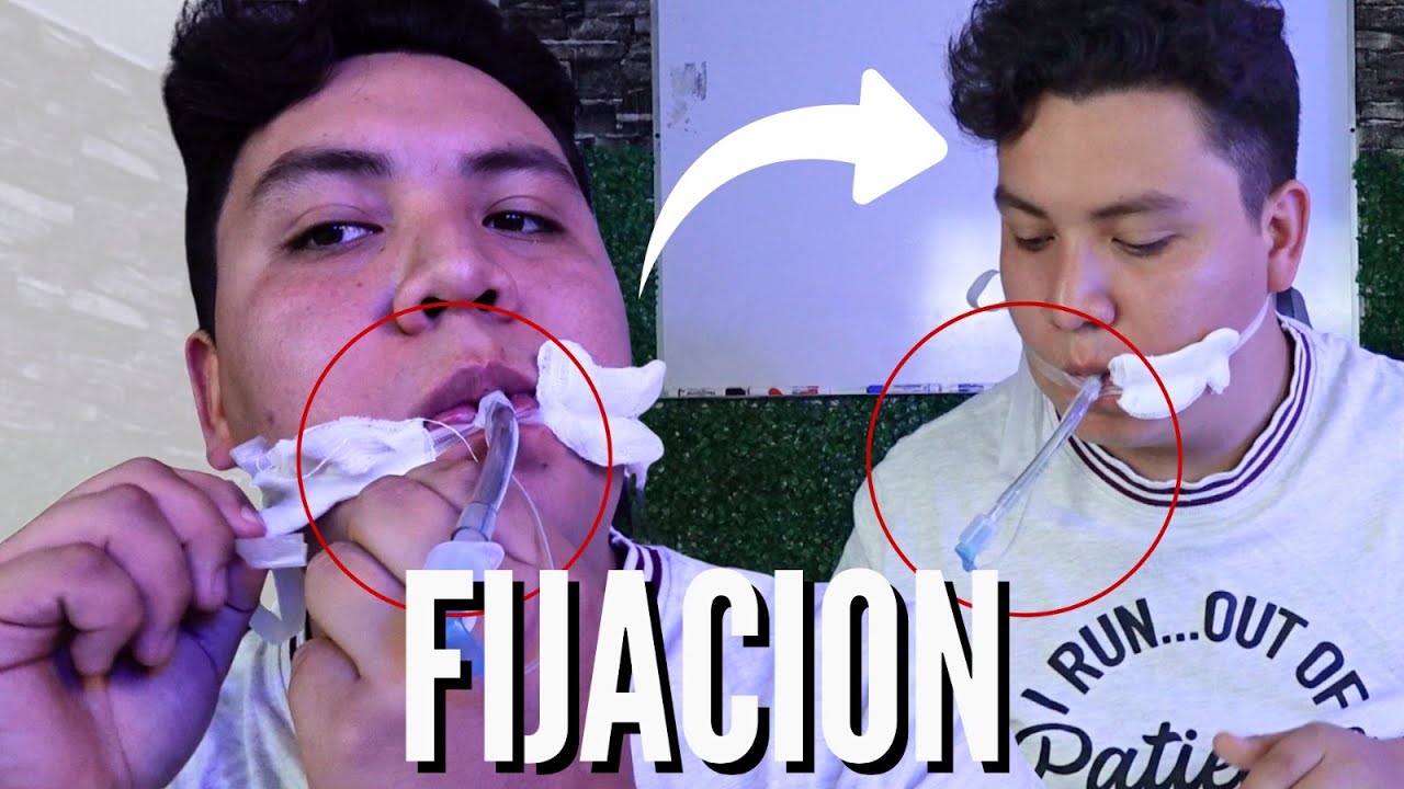 ¿Como FIJAR UN TUBO ENDOTRAQUEAL en 5 MINUTOS? | Enfermeria