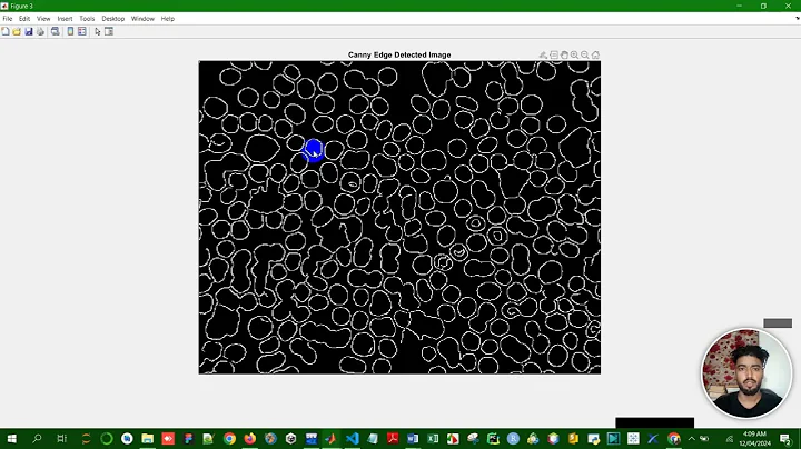 Canny edge detection using matlab image processing