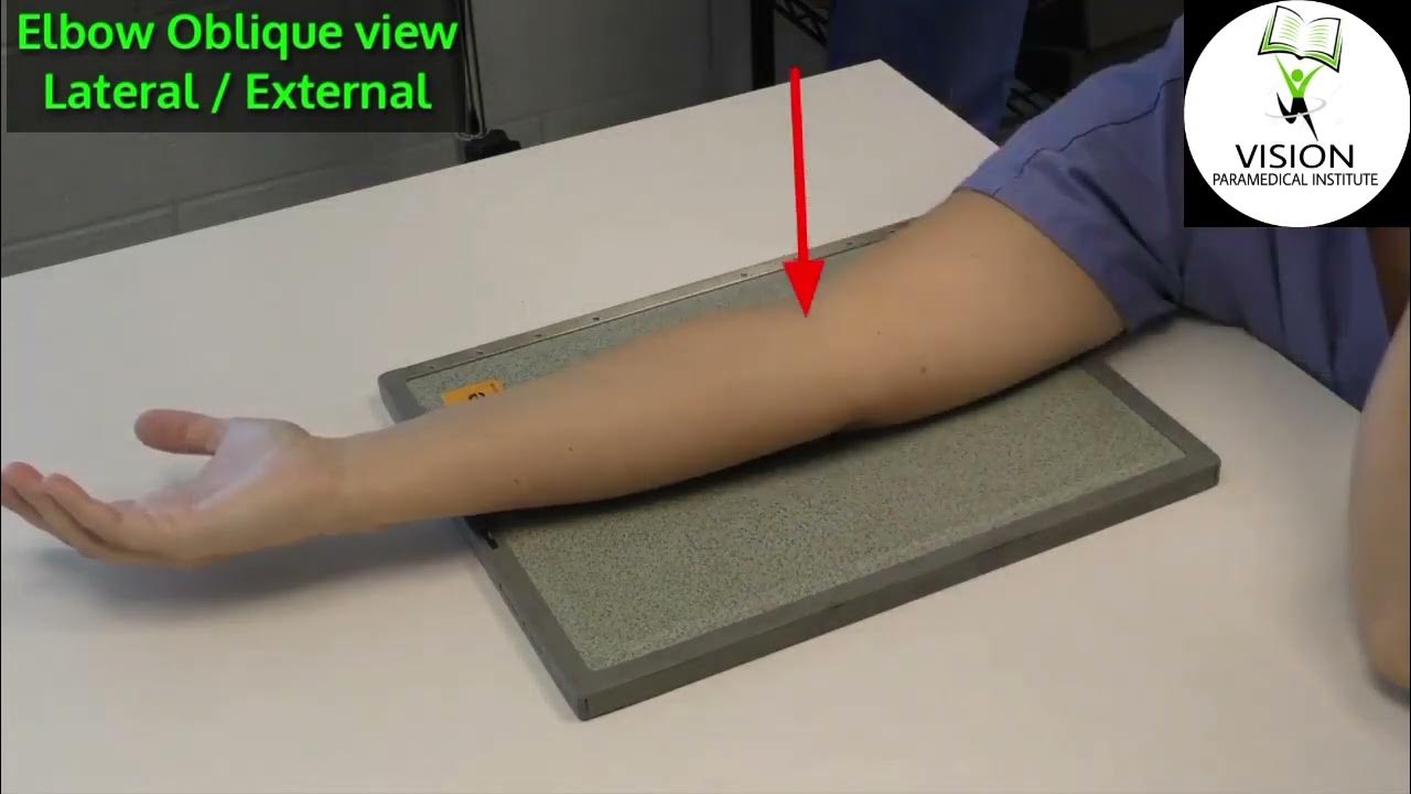 Elbow X Ray position Elbow Ap Lateral /Oblique view External & Internal