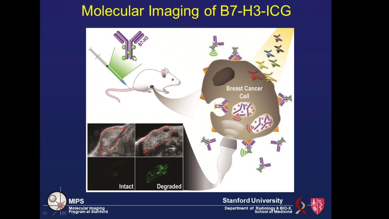June 2017: Photoacoustic Molecular Imaging of Breast Cancer using ...
