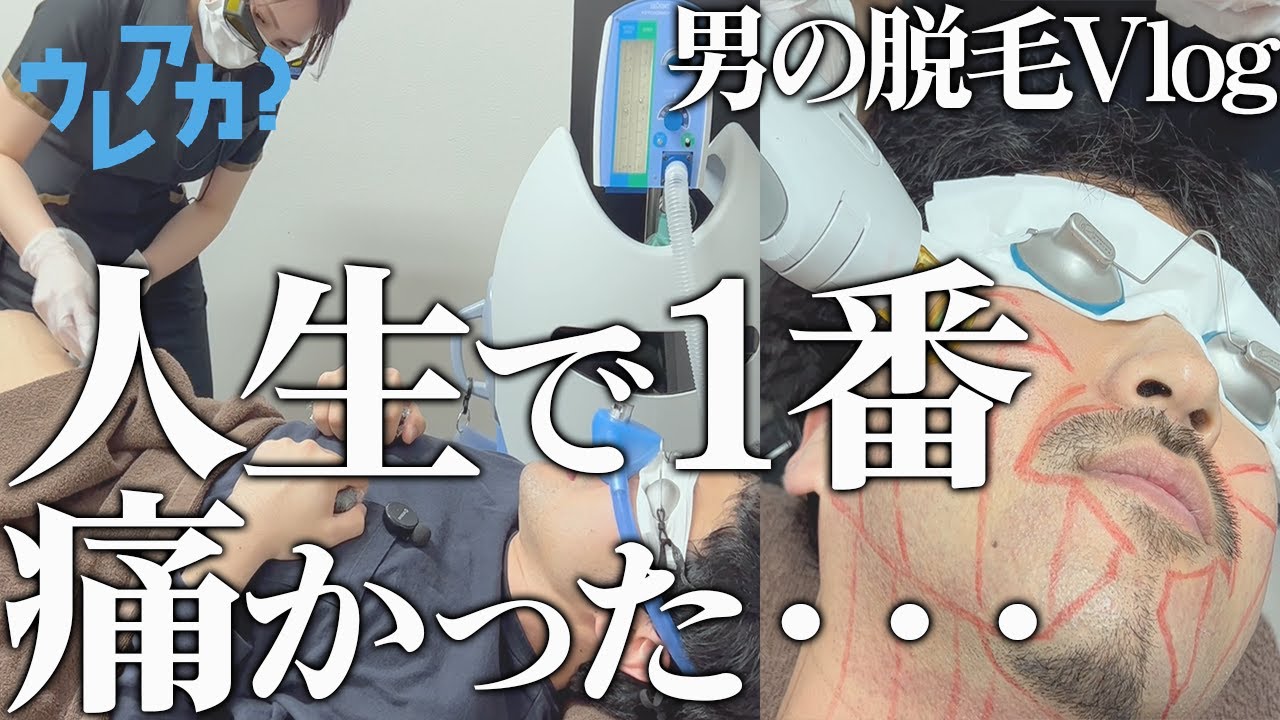 【メンズ脱毛】毛が濃い男ほど脱毛痛いってホント？【令和ロマン・素敵じゃないか・オフローズ】