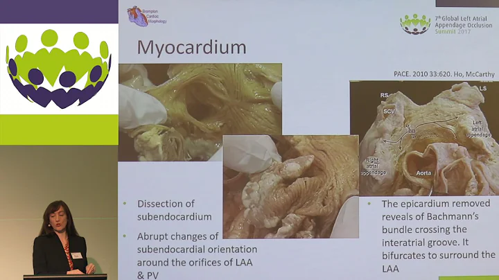 Karen McCarthy - The left atrial appendage: from e...