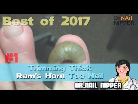 Rams Horn Nail [# 1 2017'nin En İyisi]-Kırpma Kalın Ram's Horn Toe Nail-Dr Nail Nipper (2017) D...