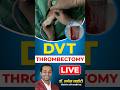 Clot removal surgery watch a live dvt thrombectomy dvtawareness viralhealthtips shotsfeed