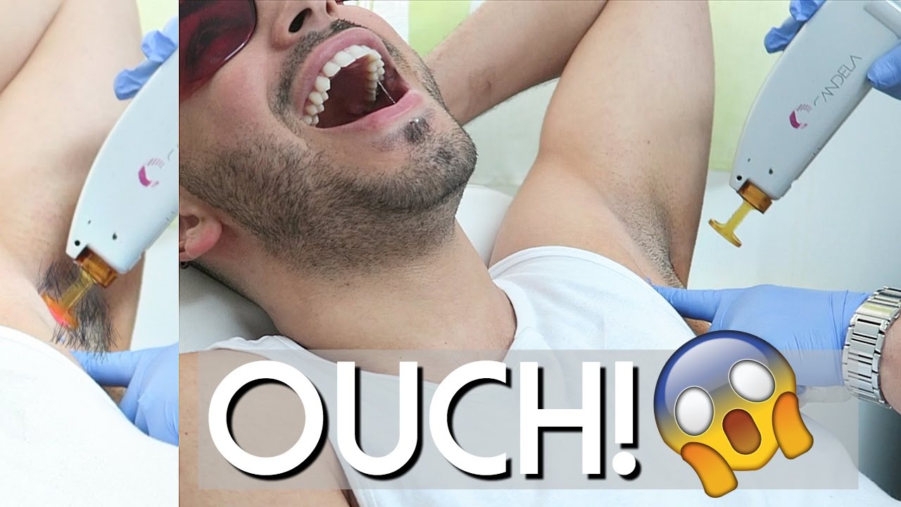 LASER HAIR REMOVAL ON ARMPIT HAIR FOR MEN | OUCH IT HURTS MALE GROOMING -  YouTube