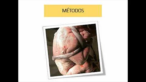 Quanto tempo para Clampear o cordão umbilical?