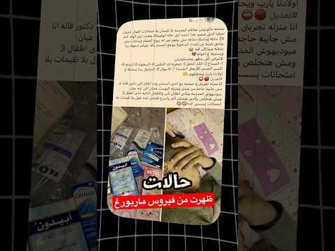 فيروس جديد ظهر اسمو ماربورغ 