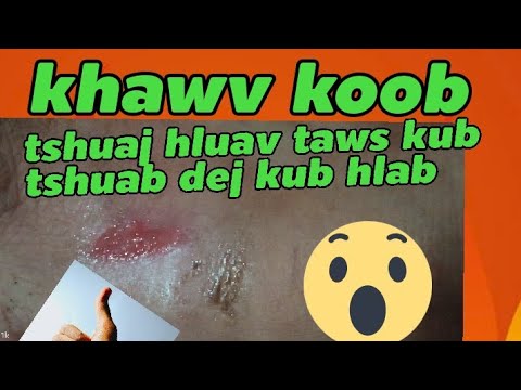 Video: Lub Tshuab Tua Hluav Taws Tau Tua Li Cas?