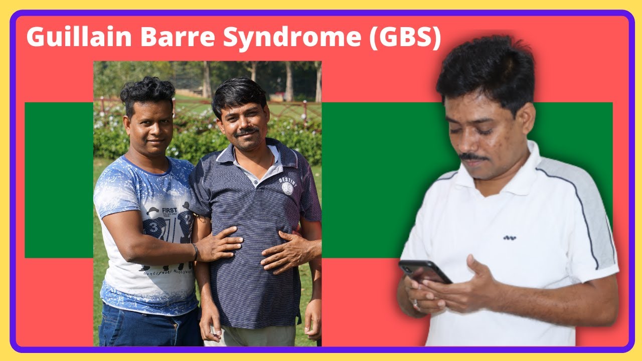 The Difficult Case of Guillain Barre Syndrome (GBS) Gbs Virus in