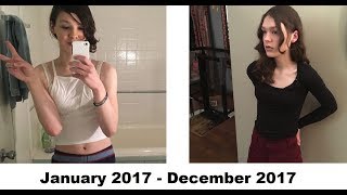 One Year on Estrogen - My Experiences