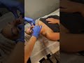Advanced Facial Anatomy Buccal Massage