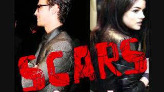 Scars: A Joe Jonas Love Story Chapter 5