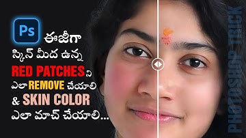 Photoshop Trick: Remove Red Patches Like a Pro! | Skin Color Matching Tips | creative space telugu