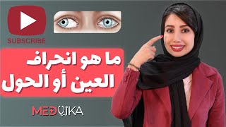 ما هو انحراف العين ؟ الاسباب و طرق العلاجها | طب العيون في ايران مع مدفيكا