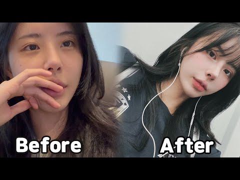 쌍수 재수술 +앞트임 VLOG 2탄 ㅣ일본여행 ❤