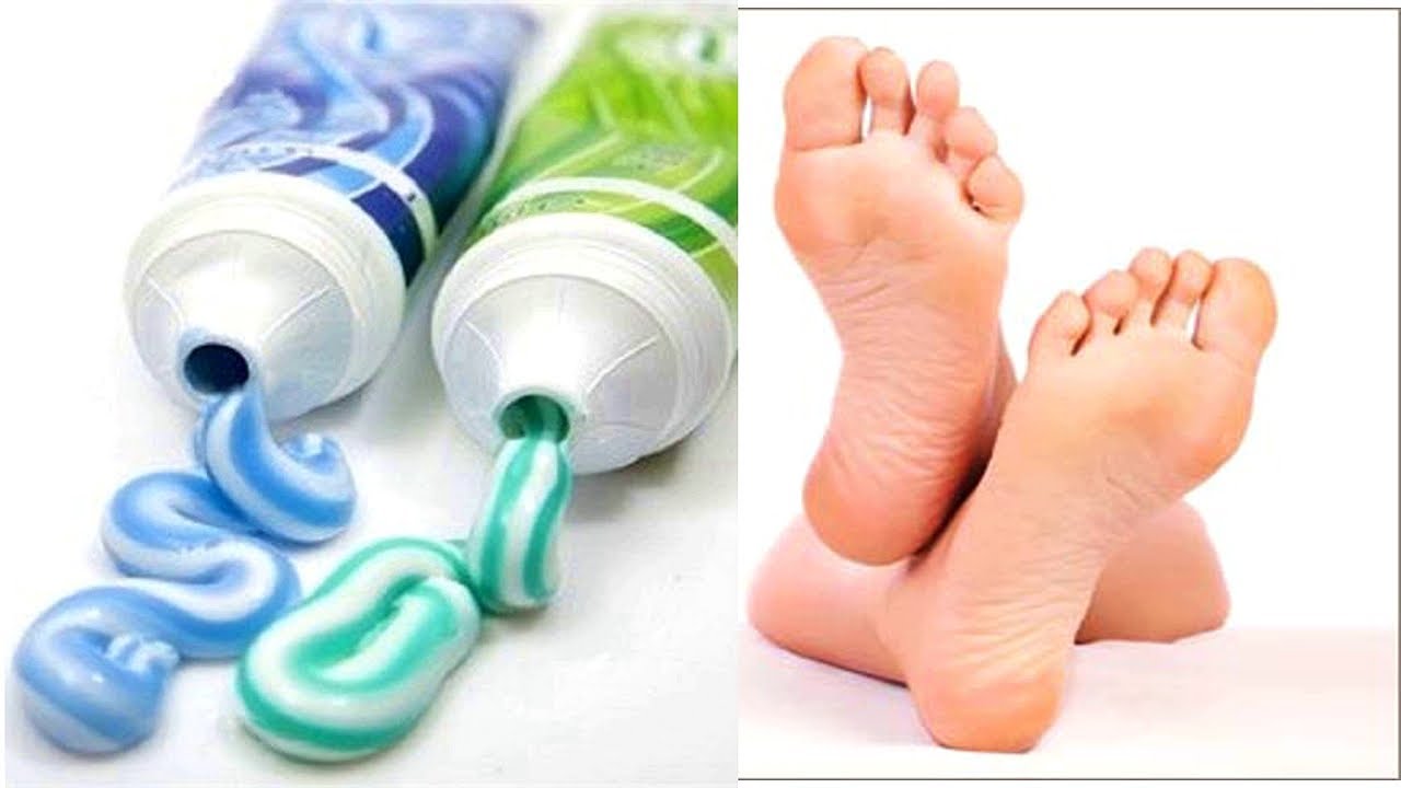 Просто Намажь ПЯТКИ зубной пастой! Эффект УДИВИТ!!! - YouTube