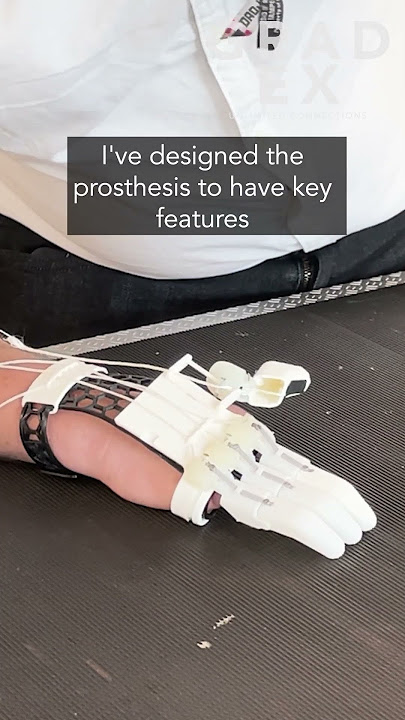 Lower Extremity Prosthetics, Westcoast Brace and Limb