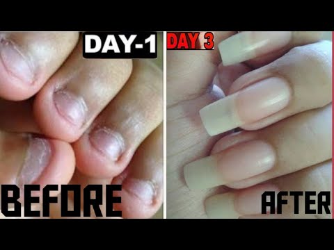 Comment faire pousser des ongles longs et solides en 3 jours – Astuces maison pour des ongles qui poussent vite