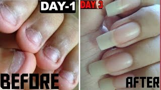 Hi guys..welcome back... today's video is how to grow your nails at
home.. watch till end and i hope you like this . if do thn share with
ur frn...