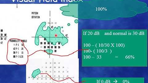 The Visual Field Index