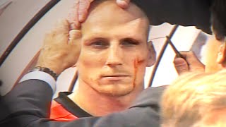 Jaap Stam eyebrow injury - EURO 2000 (Netherlands v Czech Republic)