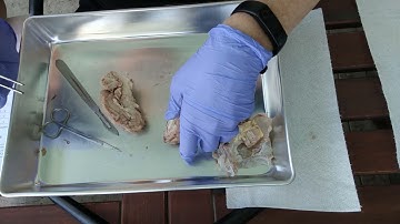 Sheep Brain- Dissection and Internal Structures