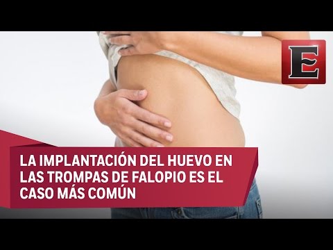 Video: Cuando los síntomas del embarazo ectópico?