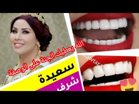 اقسم بالله لن تلجأ لطبيب الأسنان لتبيض الأسنان وصفة سعيد شرف. 