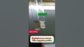 Tube coagulase test for Staphylococcus aureus.   #staphylococcus #tubecoagulase