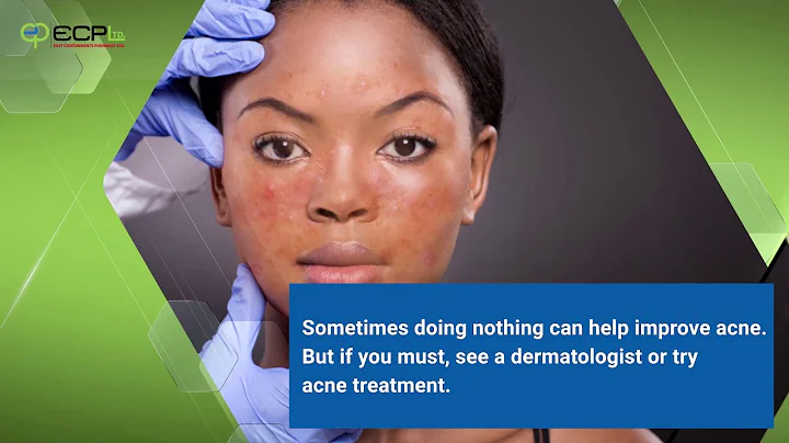 Why you shouldn’t pop your pimples